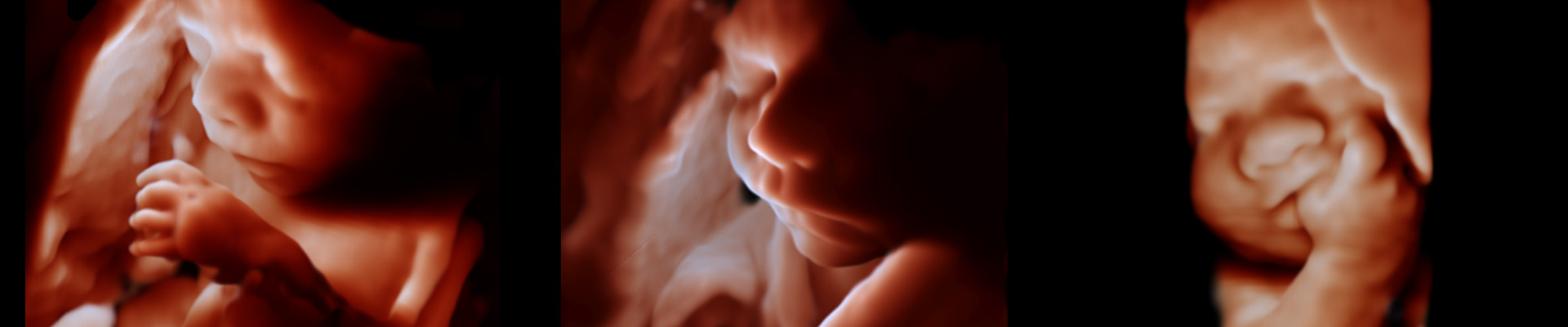 4D Ultrasound images